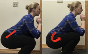 Pelvic "wink" during squat