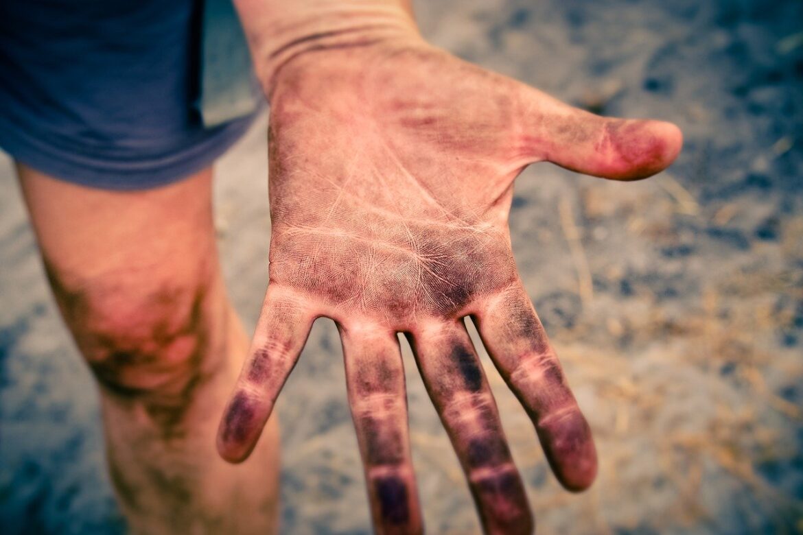 dirty hand - most common hand injuries