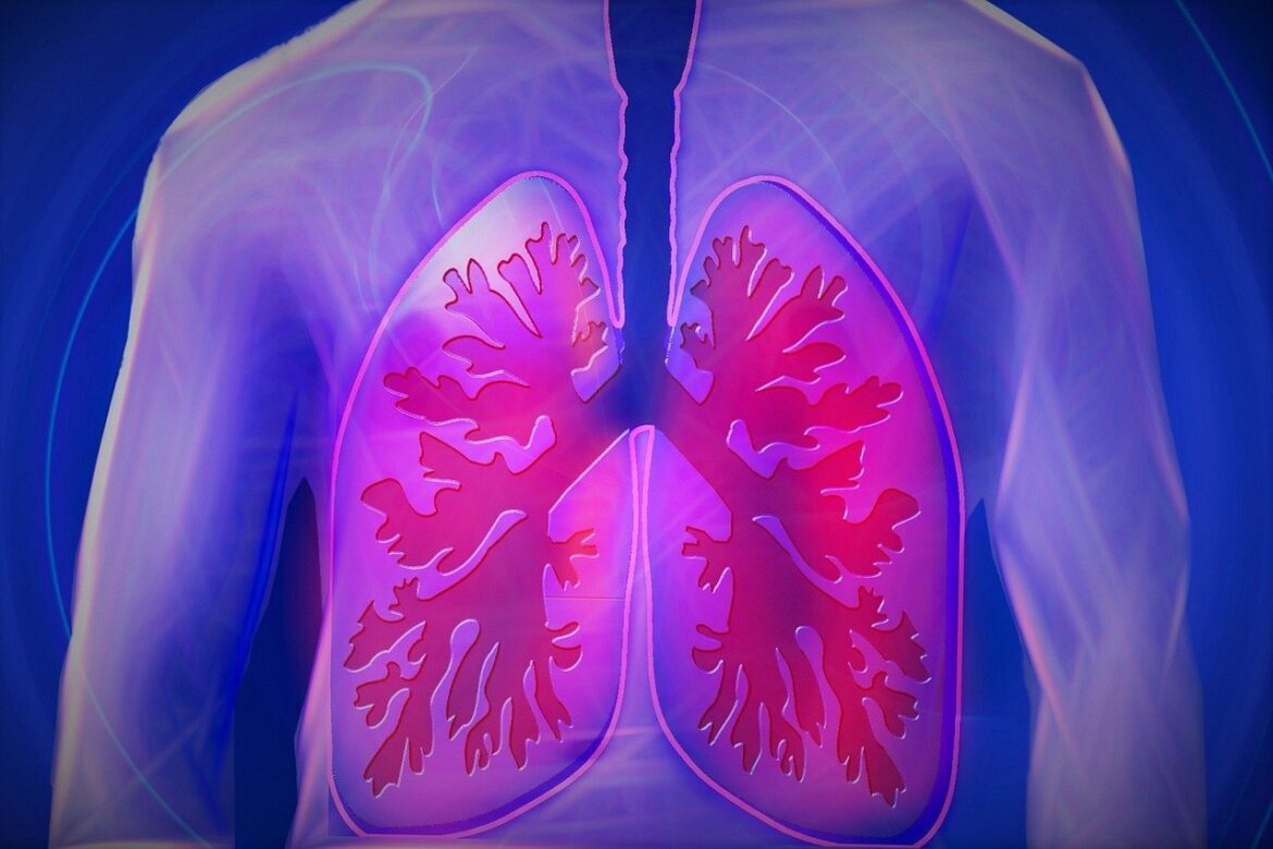 Top 5 Troublemakers for Lungs and How to Avoid Them