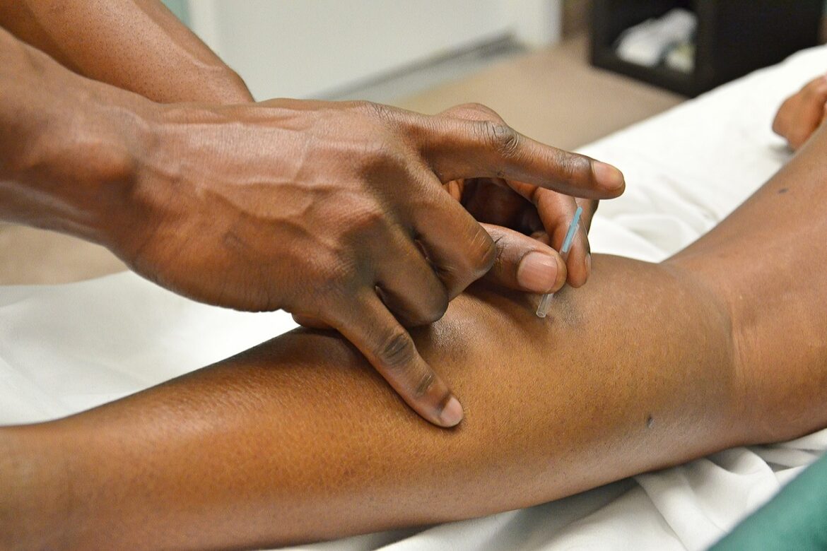 Dry Needling vs. Acupuncture: What’s the Difference?