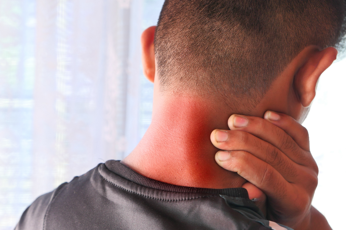 Neck Pain: What Can I Do For It?