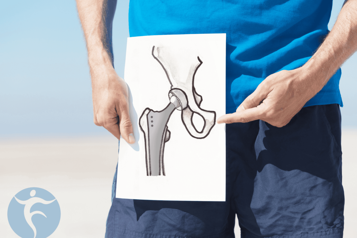 How to Know When It’s Time for a Total Joint Replacement