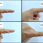 Joint Protection for Flexible Fingers