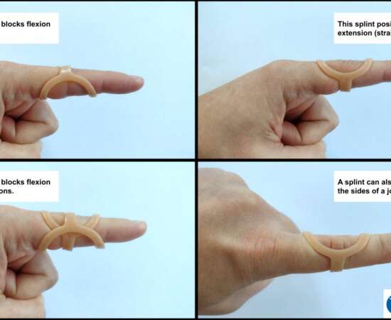 Joint Protection for Flexible Fingers