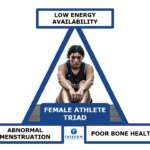 Female Athlete Triad