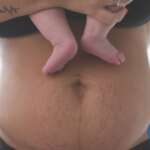 Postpartum PT 101 What to Expect at Your First Visit