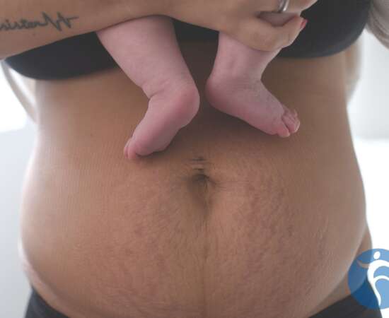 Postpartum PT 101 What to Expect at Your First Visit
