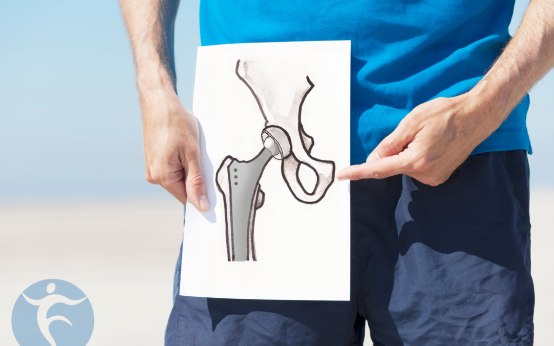 How to Know When It’s Time for a Total Joint Replacement