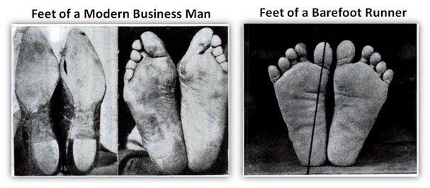 business man vs barefoot runner