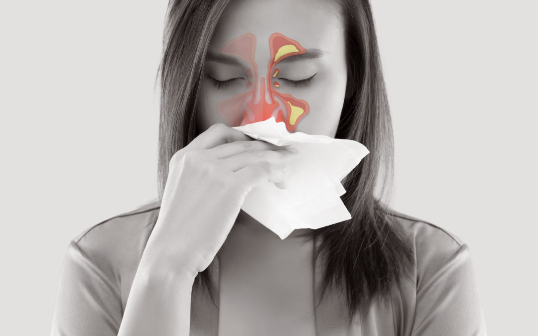 Could My Allergies Be Causing TMJ Pain?